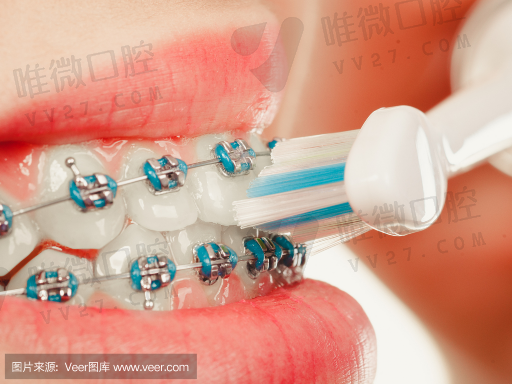 牙周治疗仪的功能用途（牙周治疗仪可以代替洁牙机吗）